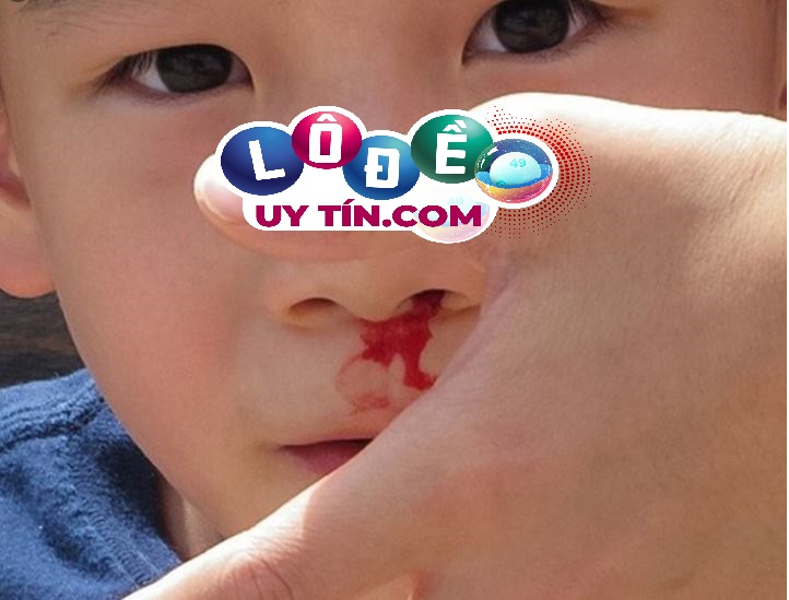 Mơ thấy chảy máu mũi, máu cam là điềm gì, đánh con gì? 31 Mơ thấy chảy máu mũi, máu cam là điềm gì, đánh con gì?